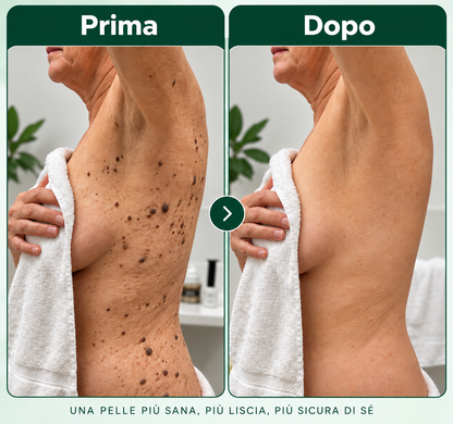 Derélia™ – Stick esfoliante all’acido glicolico per le cheratosi seborroiche