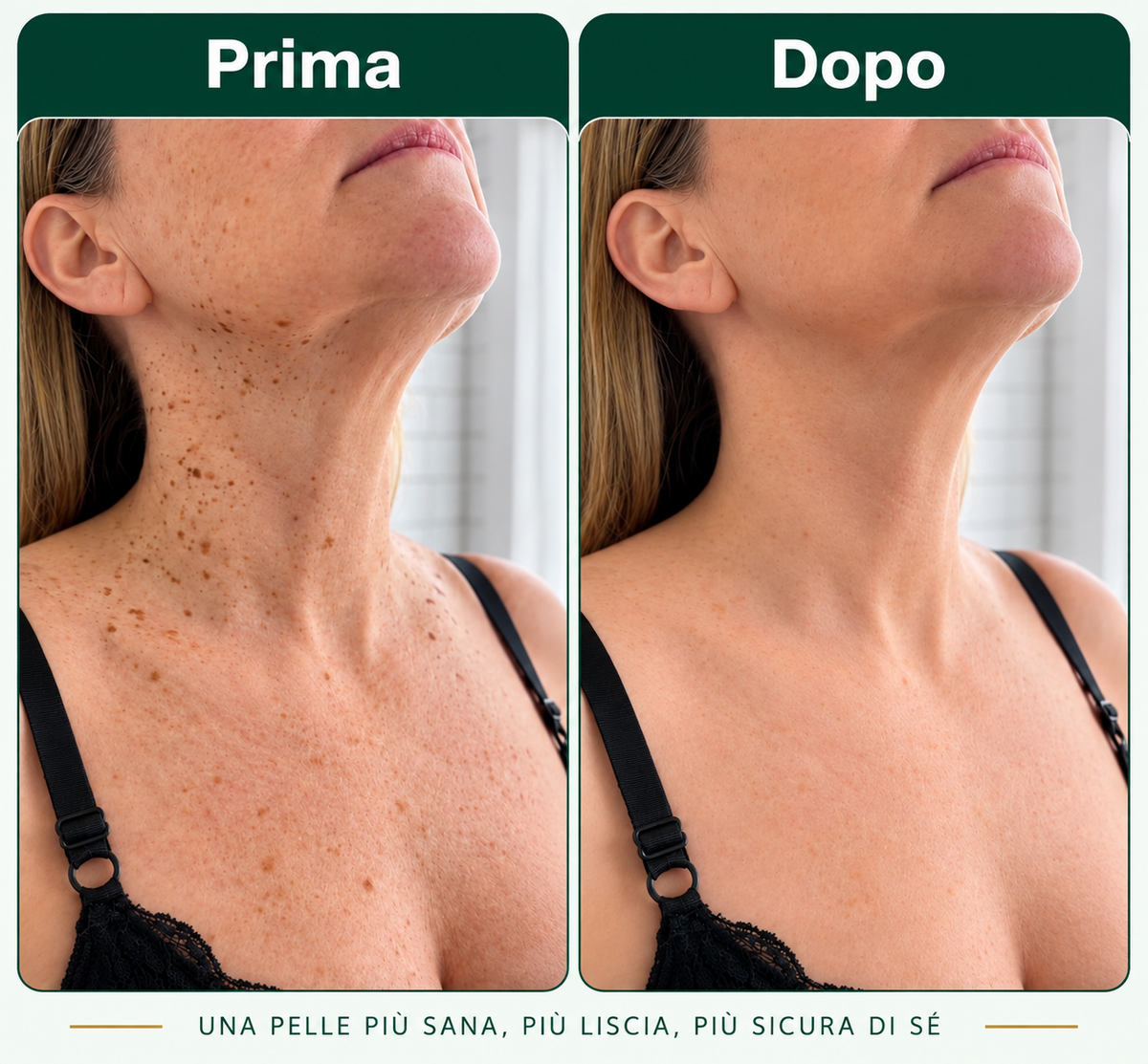 Derélia™ – Stick esfoliante all’acido glicolico per le cheratosi seborroiche