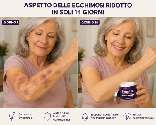 Fermélia™ — Dona di nuovo compattezza e comfort alla tua pelle fragile